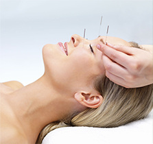 acupunctura